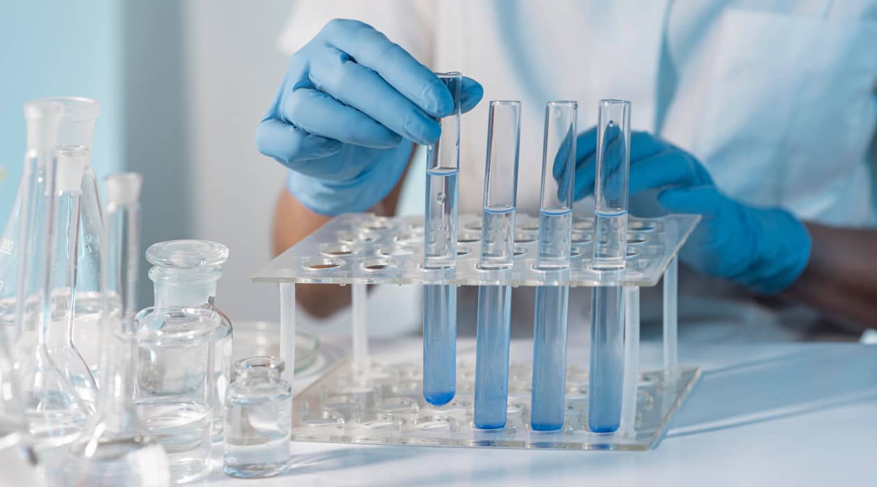 Programa tus exámenes de laboratorio a domicilio por WhatsApp